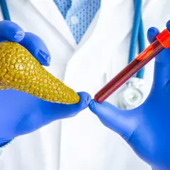 Lekarz w niebieskich rękawiczkach trzyma model trzustki i probówkę z krwią, sugerując badanie poziomu amylazy.
