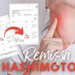 Czy choroba Hashimoto kwalifikuje do renty? Sprawdź kryteria i możliwości