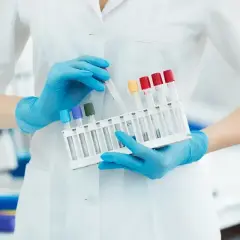 Ręce w niebieskich rękawiczkach trzymają stojak z probówkami. Czy badanie poziomu witaminy D3 jest refundowane?