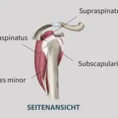 Schulteransichten: Rück-, Seiten- und Vorderansicht zeigen Muskeln wie Infraspinatus, Subscapularis und Teres minor. Bei Schmerzen im Teres minor ist eine genaue Diagnose wichtig.