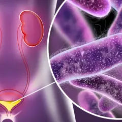 Układ moczowo-płciowy z powiększeniem bakterii. Ilustracja może pomóc zrozumieć chlamydia objawy u mężczyzn.