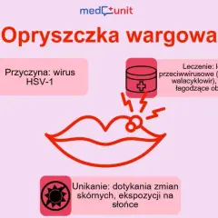 Jak zapobiec opryszczce? Skuteczne metody i dieta Sylwii Wróblewskiej