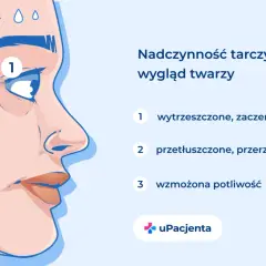 Nadczynność tarczycy objawy: wytrzeszczone oczy (1), przetłuszczone włosy (2), wzmożona potliwość (3).