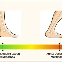Bei Achillessehne Schmerzen wann zum Arzt? Die Grafik zeigt Fußstellungen: Plantarflexion (weniger Stress) und Dorsiflexion (mehr Stress).