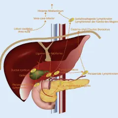 Anatomische Darstellung des Lymphknotenbesatzes im Bereich von Leber, Gallenblase und Bauchspeicheldrüse. Dargestellt sind verschiedene Lymphknotengruppen.