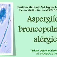 Microscopía de Aspergillus fumigatus, causante de aspergilosis broncopulmonar alérgica.