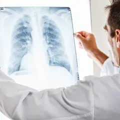 Jakie leki na zapalenie płuc są najskuteczniejsze w leczeniu?