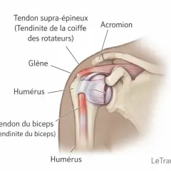 Anatomie de l'épaule montrant le tendon supra-épineux et le tendon du biceps, zones souvent affectées par une tendinite. Cet **exercice tendinite épaule** vise à soulager ces douleurs.