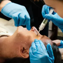 Osoba w niebieskich rękawiczkach wykonuje zabieg sinapsi na twarzy klienta, aplikując serum.
