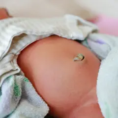 Żółty pępek po odpadnięciu kikuta, delikatnie owinięty w miękkie tkaniny.