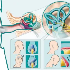 Illustrazione dell'orecchio interno e dei canali semicircolari, con diagrammi che mostrano movimenti della testa per alleviare le vertigini. Rimedi della nonna per cervicale e vertigini.