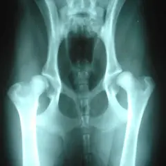 Radiografía de cadera de perro mostrando signos de displasia de cadera, una condición común en perros.