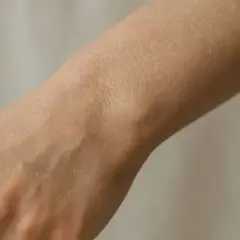 När huden blir torr och fjällande, som på dessa torra armbågar, kan det vara ett tecken på att den behöver extra fukt.