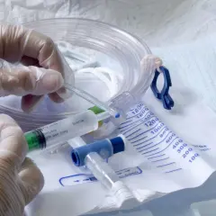 Rękawiczka medyczna trzyma strzykawkę z żelem nawilżającym, obok cewnik i worek na mocz. Czy cewnikowanie boli? Zależy od wielu czynników.