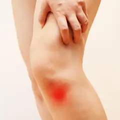 Mano che si stringe sul ginocchio con un'area rossa che indica fitte al ginocchio.
