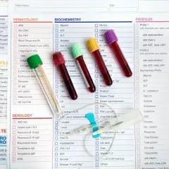 Wyniki aptt badanie, probówki krwi i formularz medyczny.