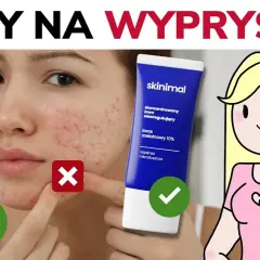 Czym smarować pryszcze? Skuteczne metody, by zniknęły szybko i bez śladu