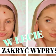 Pryszcze bez makijażu? Szybkie triki na natychmiastowy kamuflaż!