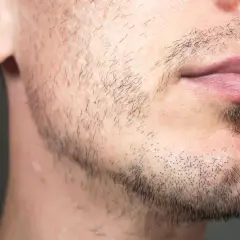 Un homme de 25 ans avec une barbe clairsemée et des lèvres roses. Il a une petite cicatrice sur la joue.