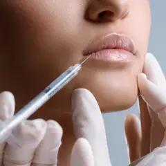 Ile kosztuje botox ust? Ceny zabiegów w Polsce i co wpływa na koszt