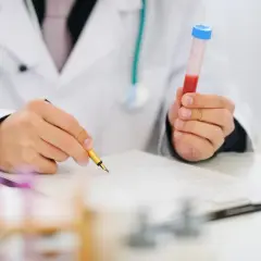 Badanie CRP: jak się bada, normy i co oznaczają wyniki?
