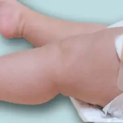 Pierna de bebé con una tirita y algodón, indicando una posible reacción vacuna gripe.