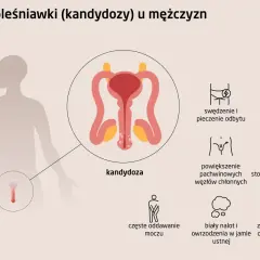 Objawy kandydozy u mężczyzn: pieczenie, spadek libido, ból podczas stosunku, zaczerwienienie narządów płciowych.