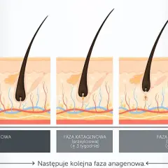 Optymalna długość włosków do depilacji woskiem: 5-10 mm?