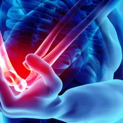 Anatomical rendering of a human arm showing a glowing red area indicating **ból łokcia**.