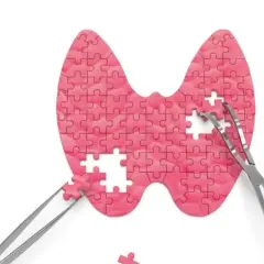 Tarczyca z puzzli, z brakującymi elementami i narzędziami chirurgicznymi. Symbolizuje problemy z hormonami tarczycy, np. niskie TSH.