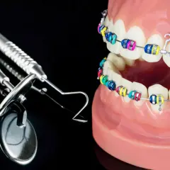 Kolorowy aparat na zgryz krzyżowy na modelach zębów, obok narzędzi dentystycznych.