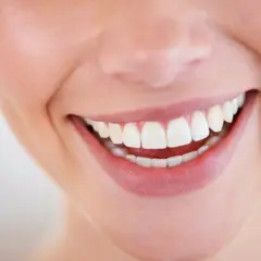 Sorriso smagliante con denti bianchi e perfetti, un vero spettacolo **male al dente** non è un problema qui.