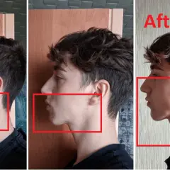 Jak ćwiczyć prawidłową pozycję spoczynkową języka dla zdrowia