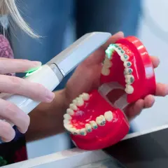 Cyfrowy wycisk zębów cena: nowoczesna technologia w stomatologii. Skaner 3D tworzy precyzyjny model szczęki z aparatem ortodontycznym.