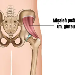Anatomia miednicy z zaznaczonym mięśniem pośladkowym małym (m. gluteus minimus), kluczowym dla stabilizacji biodra.
