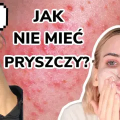 Gładka cera bez pryszczy? Odkryj sekrety eksperta!