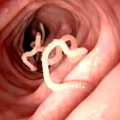 Jakie leki na pasożyty u człowieka: skuteczne metody leczenia i objawy