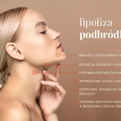 Profil kobiety po zabiegu lipolizy podbródka. Widoczna poprawa konturu żuchwy i szyi, wysmuklenie dolnej części twarzy.