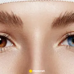 Oczy z heterochromią: jedno brązowe, drugie niebieskie. Widać delikatne zmarszczki i opaskę na głowie.