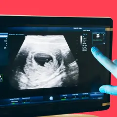 Ecografia mostra una camera gestazionale vuota, un possibile sintomo di gravidanza non evolutiva.
