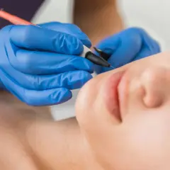 Profesjonalistka w niebieskich rękawiczkach wykonuje elektrolizę depilację na twarzy klientki.