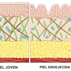 Comparación de piel joven y envejecida, mostrando la degradación de la elastina y la reducción de colágeno en la piel madura.