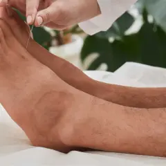 Acupuncture sur un pied, visant un point de pression pour un massage thérapeutique.