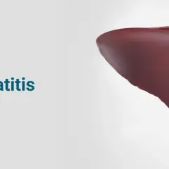 Medicamentos para el hígado alcohólico: ¿realmente protegen tu salud?