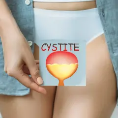 Une main tient une carte illustrant une vessie enflammée, avec le mot "CYSTITE" écrit en rouge. Cela peut aider à comprendre comment attraper une infection urinaire.