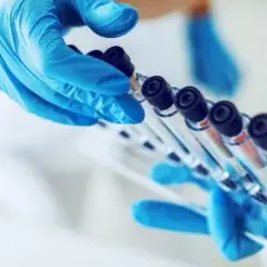 Jak się przygotować do badania AMH - uniknij najczęstszych błędów