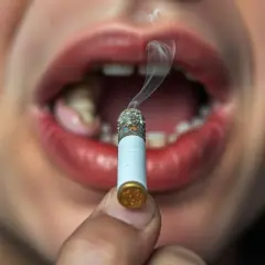 Czy można palić po wizycie u dentysty? Sprawdź, dlaczego warto unikać