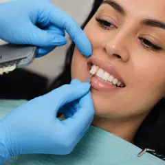 Dobór idealnego odcienia licówek kompozytowych. Dentysta porównuje kolor zębów pacjentki z wzornikiem.
