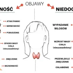Niedoczynność tarczycy u nastolatków objawy, które mogą cię zaniepokoić