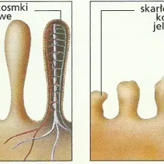 Nietolerancja glutenu: objawy, różnice, diagnoza i dieta